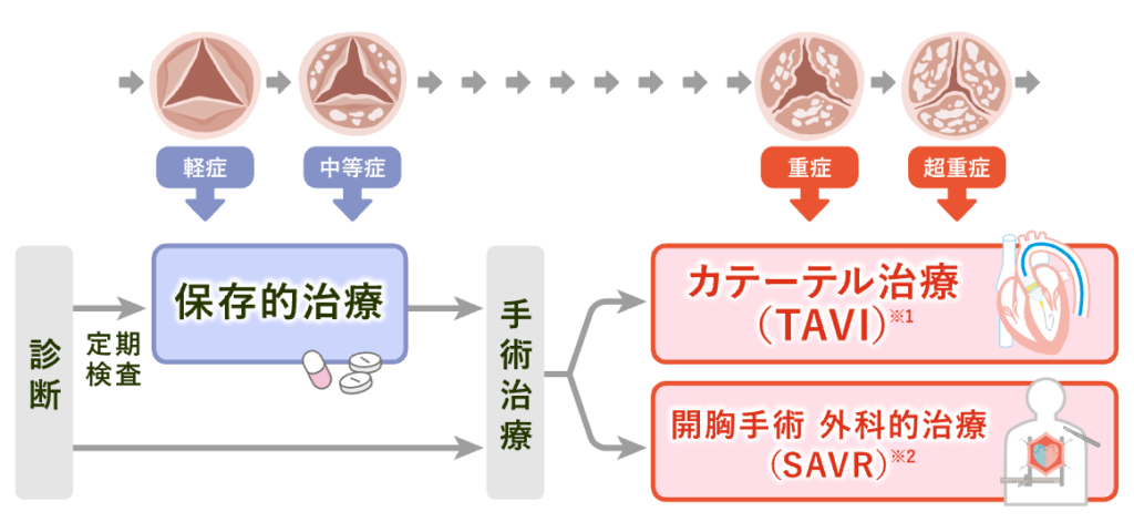 大動脈弁狭窄症の治療計画