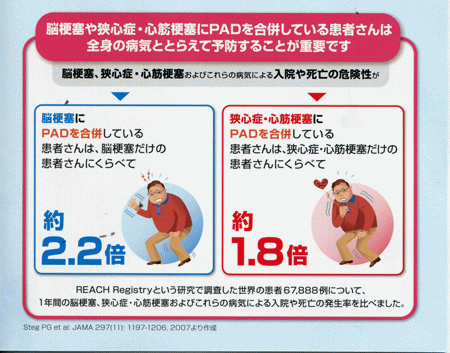 脳梗塞や狭心症・心筋梗塞にPADを合併している患者さんは全人の病気ととらえて予防することが重要です